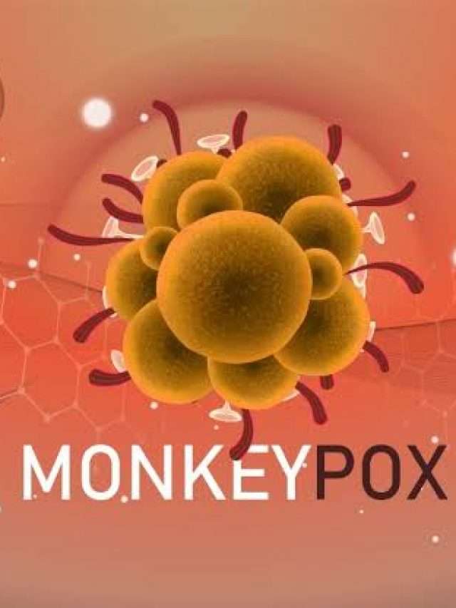 Monkeypox: What to Know